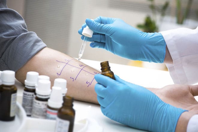 allergy-overview-testing